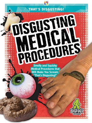 cover image of Disgusting Medical Procedures